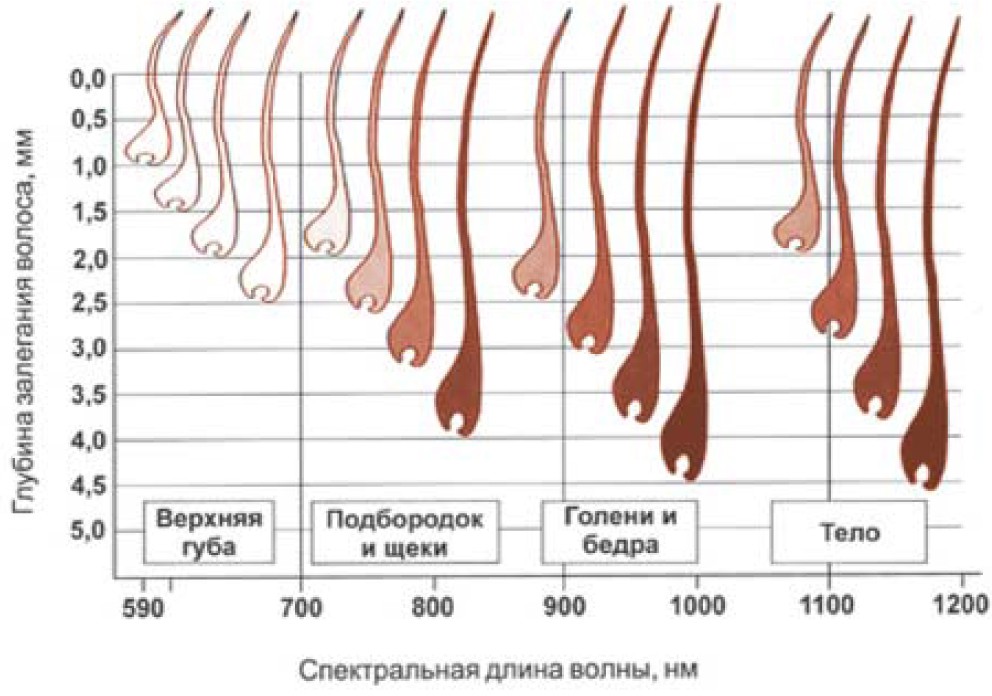 Лазерная эпиляция в косметологии ЛИДАМЕД